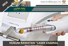 Laser