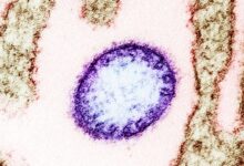 virus nipah