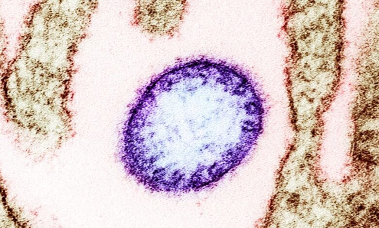 virus nipah